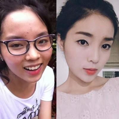 Kỳ Duyên bị cho là đã đụng dao kéo.