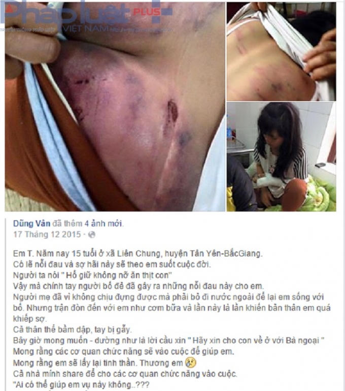 Hình ảnh, thông tin vụ cha đánh con gái hơn kẻ thù được chia sẻ nhiều trên cộng đồng mạng xã hội. Nguồn: Facebook