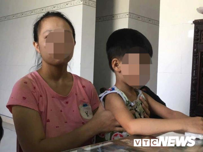 Gia đình cháu Triều tố cô Y. tát vào đầu khiến cháu bị chấn động não.