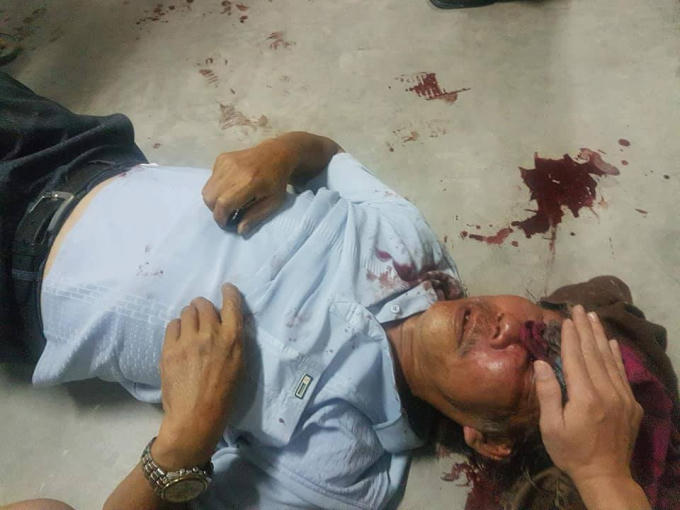 Nhà thơ Phan Văn Quang bị hành hung tại chung cư SaiGon Metro Park.