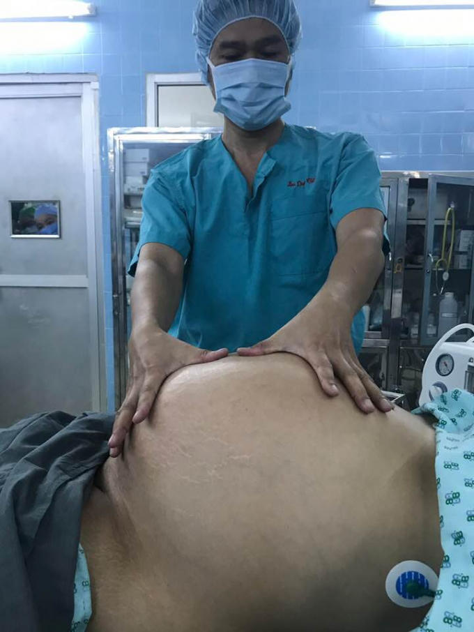 Người phụ nữ có vòng bụng to 120cm.