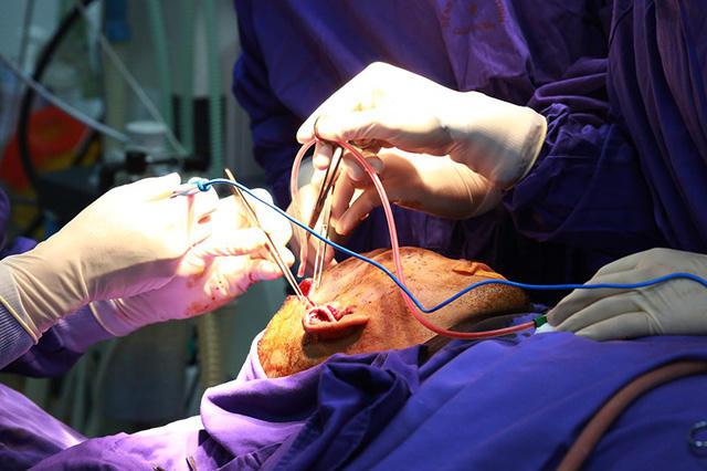 ​Trên 80% dị vật ra khỏi vùng hàm mặt.