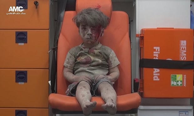 Khuôn mặt thất thần của Omran. (Ảnh: Trung tâm truyền thông Aleppo)