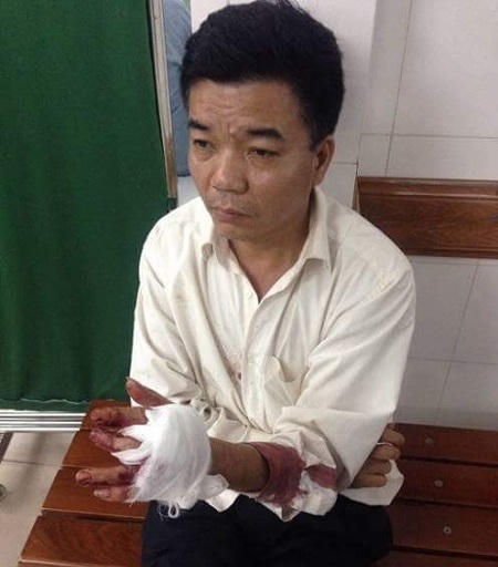 Ông Nguyễn Đoàn Bộ (bảo vệ công ty) tại cơ quan công an với vết tay bị chém. ( Ảnh: Đông Bắc)