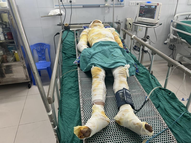 Cháu Mạnh bị bỏng toàn thân, rất cần sự hỗ trợ của các mạnh thường quân với những tấm lòng nhân ái.
					
				
			
			

			
			
			Cháu Mạnh bị bỏng toàn thân, rất cần sự hỗ trợ của các mạnh thường quân với những tấm lòng nhân ái.