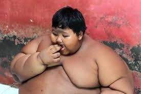 Cậu bé Arya Permana, người Indonesia, nặng tới 192 kg. Ảnh: Web.de