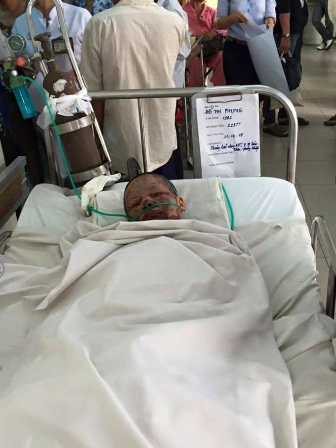 Phụng đang nằm điều trị đặc biệt tại BV Chợ Rẫy, chưa qua khỏi tình trạng nguy kịch. Ảnh: người thân cung cấp