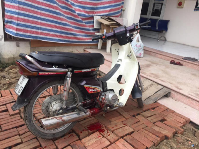 Do bị đạn nổ trúng đùi, nam thanh niên bị chảy nhiều máu.