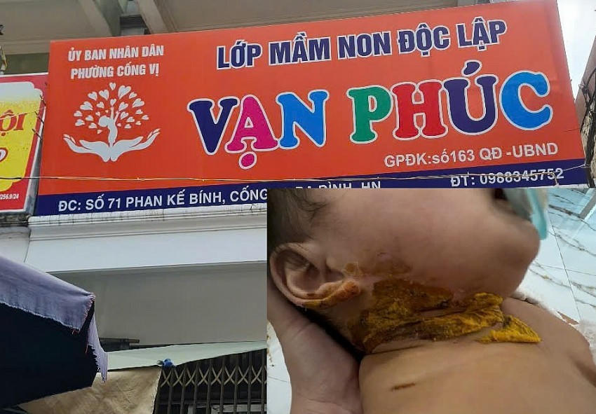 Lớp Mầm non Độc Lập Vạn Phúc đóng trên địa bàn phường Cống Vị nơi xảy ra sự việc cháu bé 9 tháng tuổi bị bỏng nặng phải nhập viện điều trị.