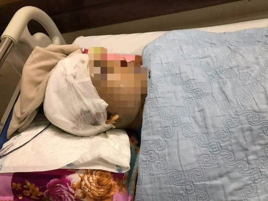 ông Nguyễn Văn Hanh đang được điều trị tại bệnh viện Việt Đức.