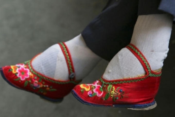 Kiểu dáng thường "chúc về phía trước".