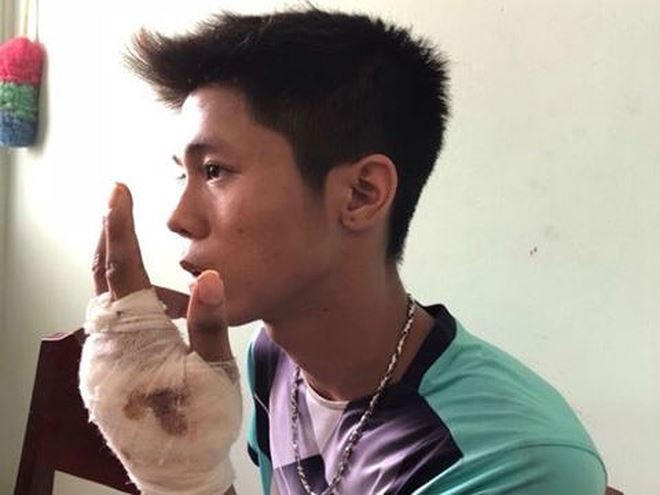 Khi gây án, nghi can Tình bị thương tích ở tay trái.