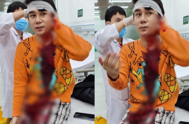 Khởi tố vụ án diễn viên phim 'Thương ngày nắng về' bị chém trọng thương