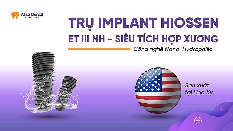 Nha khoa Alisa - Địa chỉ trồng răng Implant uy tín tại Hà Nội