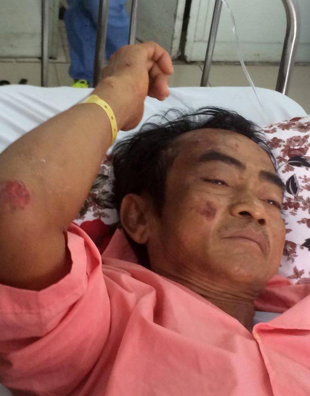 Ông Nén đã qua cơn nguy kịch.