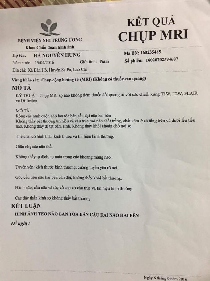 Kết quả chụp MRI cho thấy cháu bé không bị bại não bẩm sinh.
