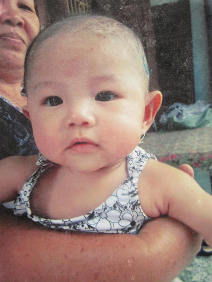Nhiều người bệnh từ trẻ em đến người lớn mắc chàm đã được ông chữa khỏi.