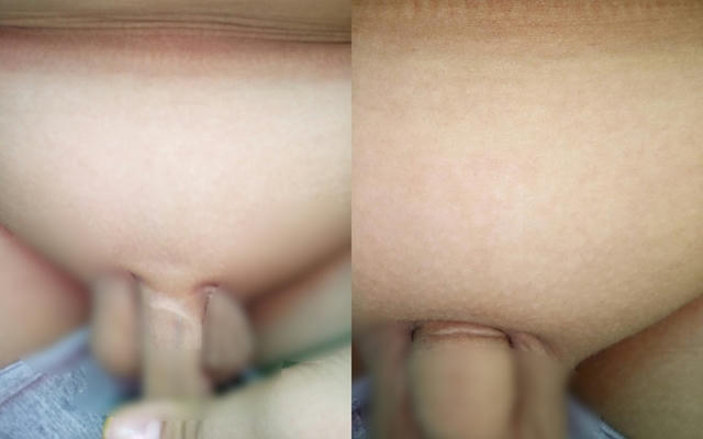 Bé trai bị bố đẻ, mẹ kế tra tấn như thời trung cổ suốt gần 7 năm đến rách cả dương vật