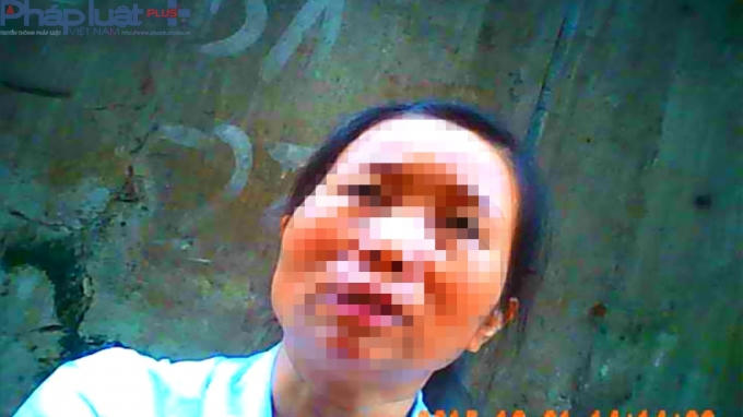 Một cán bộ tên Lợi, thuộc Bệnh viện đa khoa Trung tâm Thái Nguyên.