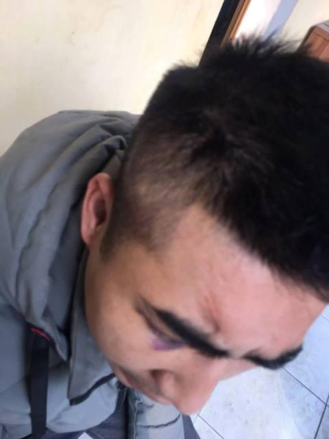 Người gây tai nạn chỉ bị thương tích nhẹ.