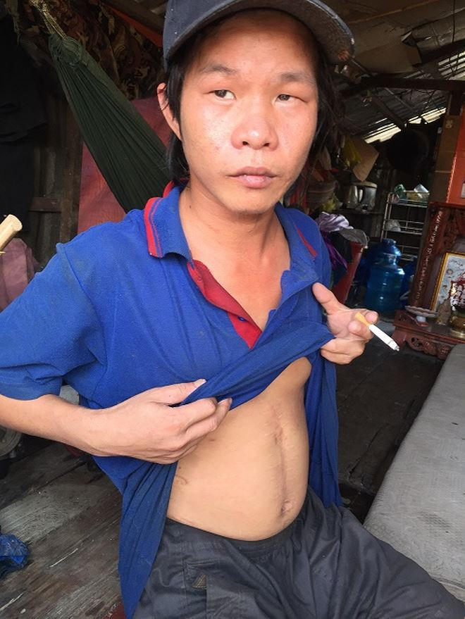 Tâm bị thương vỡ tụy, mẹ phải bán nền đất tái định cư chạy chữa, gia đình bị đuổi ra ngoài đường.