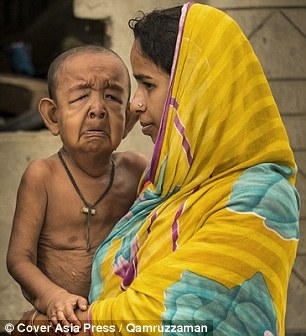 Mẹ cậu v&ocirc; c&ugrave;ng buồn l&ograve;ng v&igrave; căn bệnh n&agrave;y.