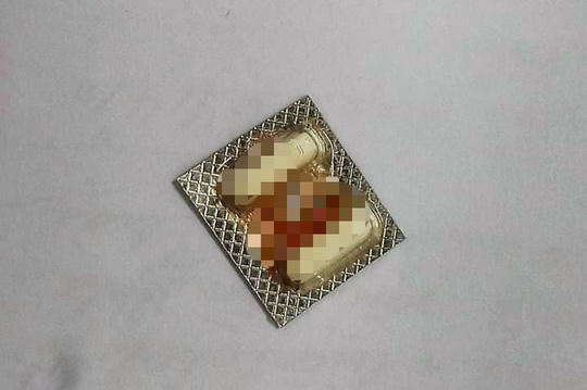 2 vi&ecirc;n thuốc c&ograve;n nguy&ecirc;n vỉ bị mắc trong thực quản của bệnh nh&acirc;n L. được c&aacute;c b&aacute;c sĩ gắp ra th&agrave;nh c&ocirc;ng - Ảnh: Tấn Dũng