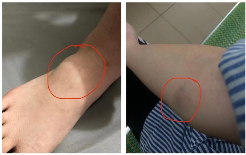 Vụ Phó hiệu trưởng trường THPT Vân Nội bị tố đánh nữ sinh: Công an huyện Đông Anh nói gì? ảnh 1