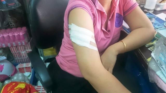 Vết thương ở tay chị H do bị chém