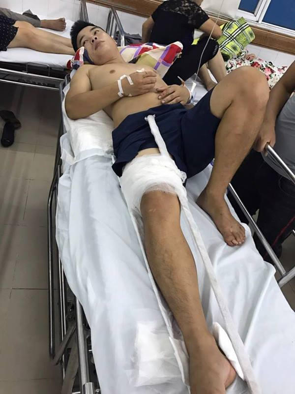 Vì vết thương quá nặng, nạn nhân đã được chuyển bệnh viện Việt Đức (Hà Nội) trong đêm.
