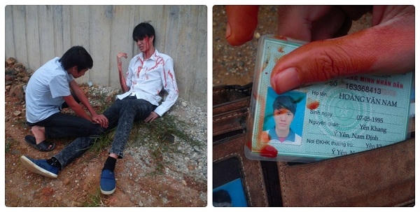 Nam thanh niên gặp nạn sau khi cứu sống hai cô gái đang cố vượt qua đường ray tàu hỏa.