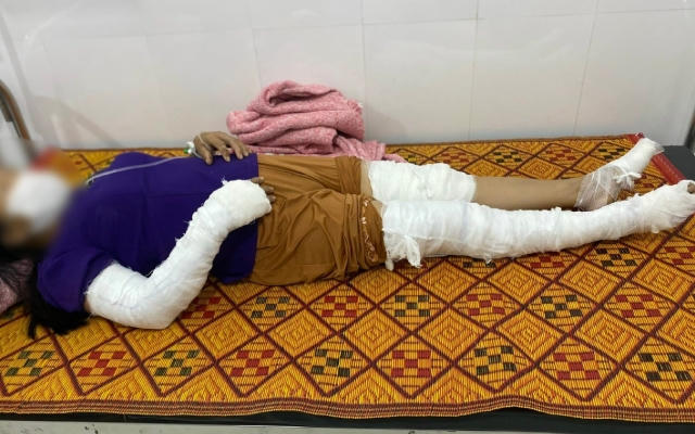 Dựng cây nêu đón Tết, nhóm người bị điện giật cháy xém