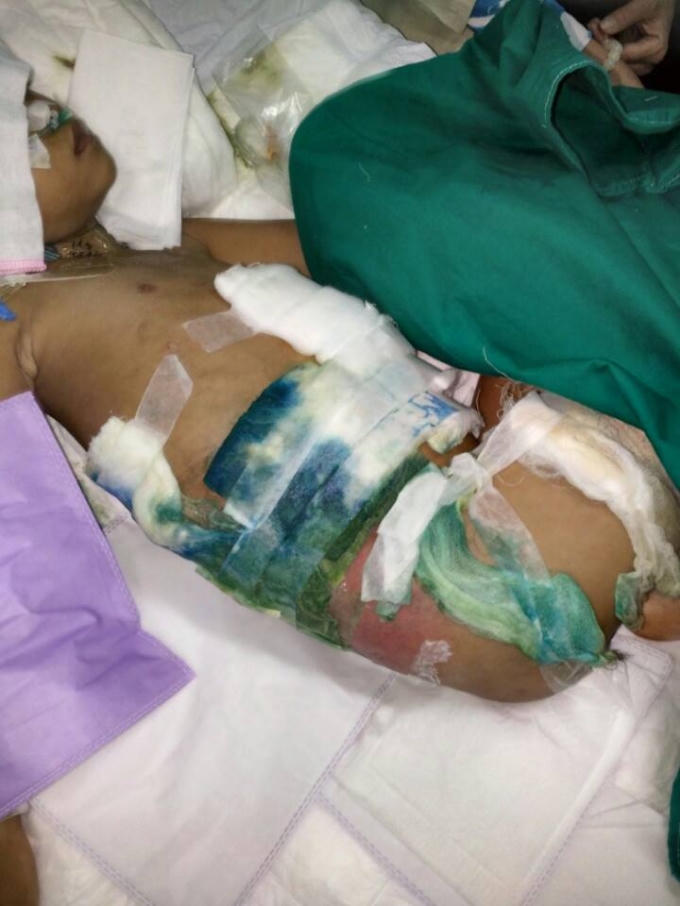 Bé nằm vật vã trong cơn đau thể xác.