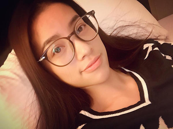 Đây là bằng chứng đáp trả những tin đồn cô phẫu thuật thẩm mỹ. Ảnh: Internet