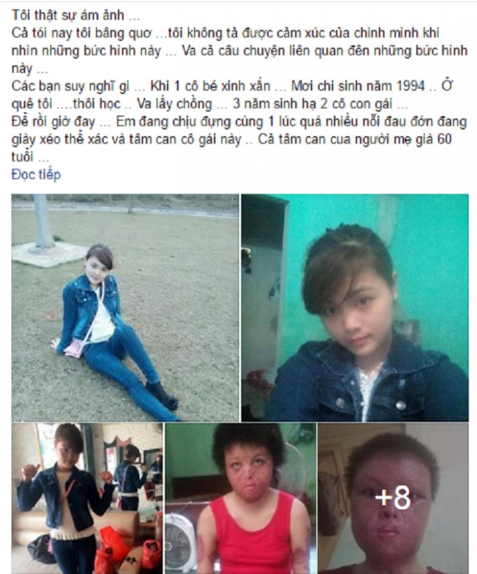 Câu chuyện bạo lực gia đình khiến dân mạng phẫn nộ tột cùng. (Nguồn: Facebook).