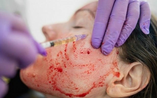 Bác sĩ Bệnh viện Da liễu Trung ương: