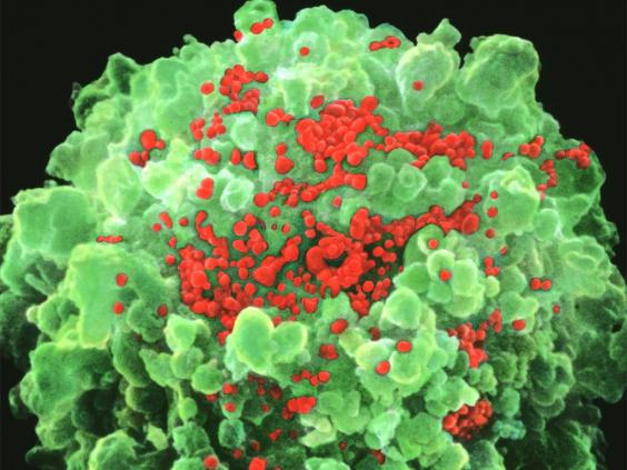 Hình ảnh hiển vi của virus HIV. (Ảnh: Independent).