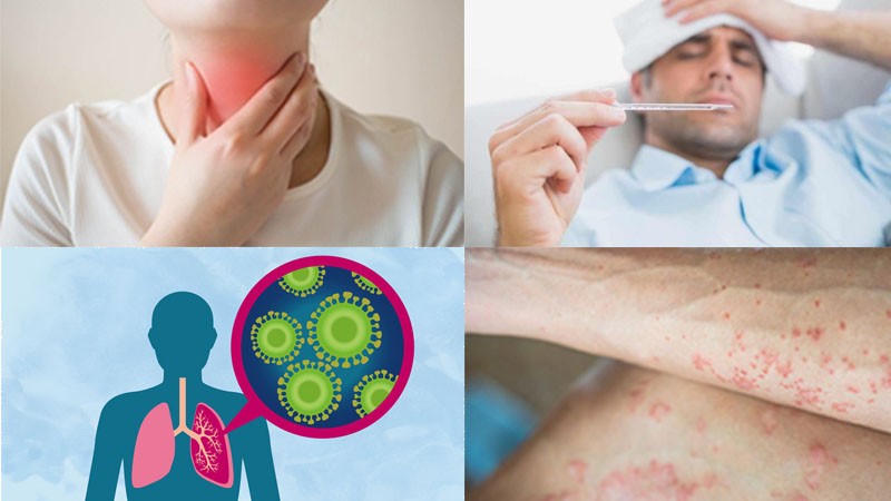 Một số các triệu chứng xuất hiện khi bệnh nhân nhiễm bệnh bạch hầu. Ảnh minh họa