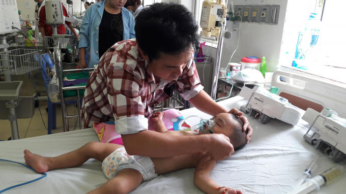 Bé trai 19 tháng tuổi được người thân đưa đến bệnh viện cấp cứu với gần 1000 nốt ong đốt khắp cơ thể.