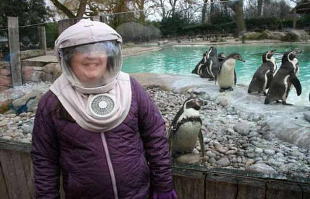 Caitlin buộc phải thoa kem chống nắng 3 giờ một lần.