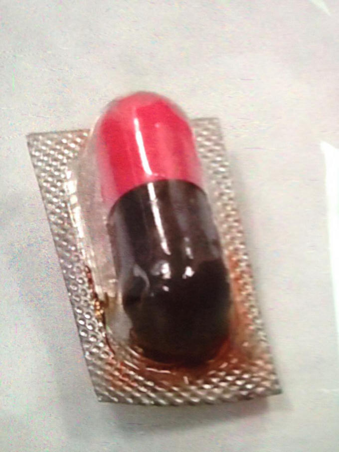 Viên thuốc được các bác sỹ đã gắp ra khi còn nguyên vỏ nhôm, từ phế quản gốc bên phải của bệnh nhân. Ảnh: Mai Thanh