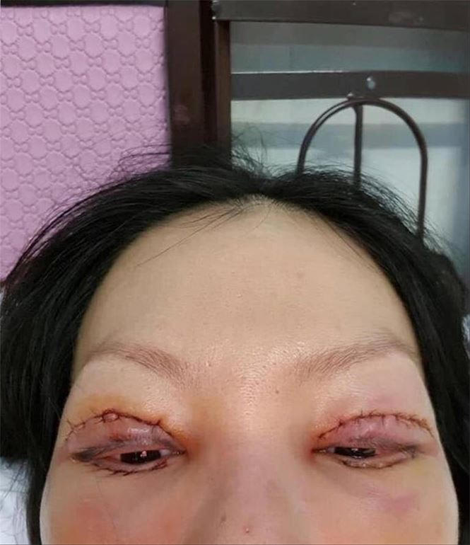 Một kh&aacute;ch h&agrave;ng v&igrave; tin v&agrave;o quảng c&aacute;o tr&ecirc;n mạng đ&atilde; phải trả gi&aacute; đắt.