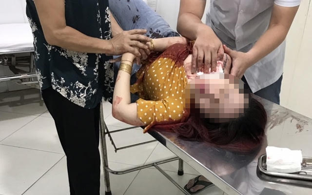 Kẻ chém nhiều nhát vào cổ người phụ nữ ở Bình Dương đã ra đầu thú