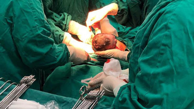 Bé Đàm Thị Phương Mai cất tiếng khóc chào đời lúc 0 giờ 3 phút ngày 1/1/2019 bằng phương pháp sinh mổ. (Nguồn: Bệnh viện Phụ sản Trung ương).