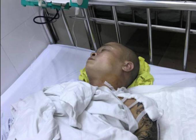 Anh Trương Vĩnh Thắng đang được điều trị tích cực sau ca mổ tại BV 103.