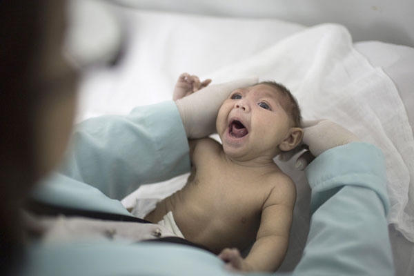 Châu Âu đã phát hiện trường hợp trẻ nhỏ đầu tiên bị dị tật do nhiễm virus Zika. Ảnh: minh họa