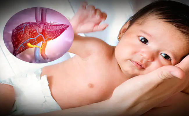 ệnh viêm gan cấp chưa rõ nguyên nhân ở trẻ em