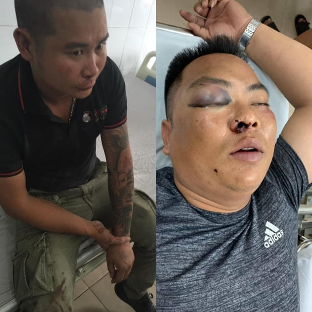 2 nhân viên đòi nợ của Công ty Hưng Thịnh đang được điều trị tại bệnh viện ở Hà Nội.