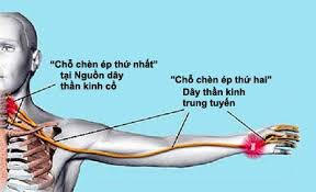 Dễ d&agrave;ng ngừa tr&aacute;nh