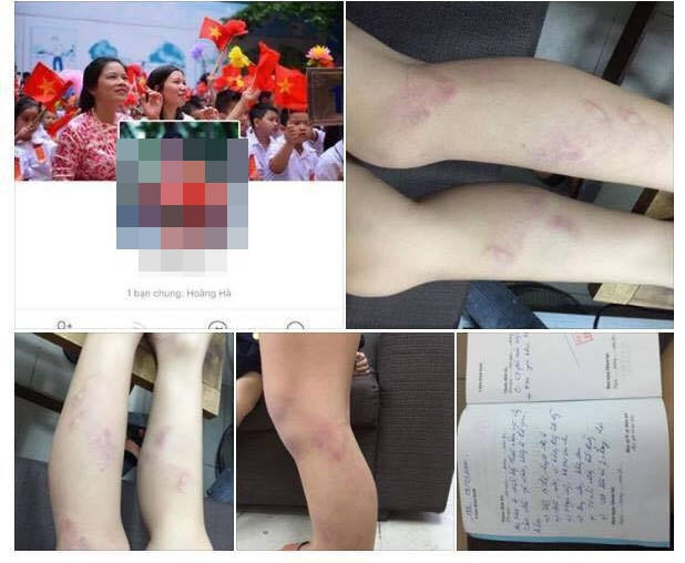 Chủ tịch UBND TP Hà Nội yêu cầu làm rõ vụ 11 học sinh lớp hai được cho là bị cô giáo bạo hành